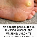 UKLONITE KURIJE OKO ZA SAMO 2 DANA: Ne bacajte pare, LIJEK JE U VAŠOJ KUĆI CIJELO VRIJEME UKLONITE KURIJE OKO ZA SAMO 2 DANA: Ne bacajte pare, LIJEK JE U VAŠOJ KUĆI CIJELO VRIJEME - featured image