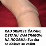 KAD SKINETE ČARAPE OSTANU VAM TRAGOVI NA NOGAMA: Evo šta se dešava sa vašim zdravljem KAD SKINETE ČARAPE OSTANU VAM TRAGOVI NA NOGAMA: Evo šta se dešava sa vašim zdravljem - featured image