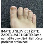 IMATE LI GLJIVICE I ŽUTE, ZADEBLJALE NOKTE: Samo namažite ovo ulje i riješit ćete problem preko noći IMATE LI GLJIVICE I ŽUTE, ZADEBLJALE NOKTE: Samo namažite ovo ulje i riješit ćete problem preko noći - featured image