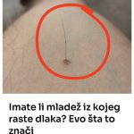 Evo šta tačno znači kada vam iz mladeža raste dlaka: Da li je to opasno, iznenadit ćete se Evo šta tačno znači kada vam iz mladeža raste dlaka: Da li je to opasno, iznenadit ćete se - featured image