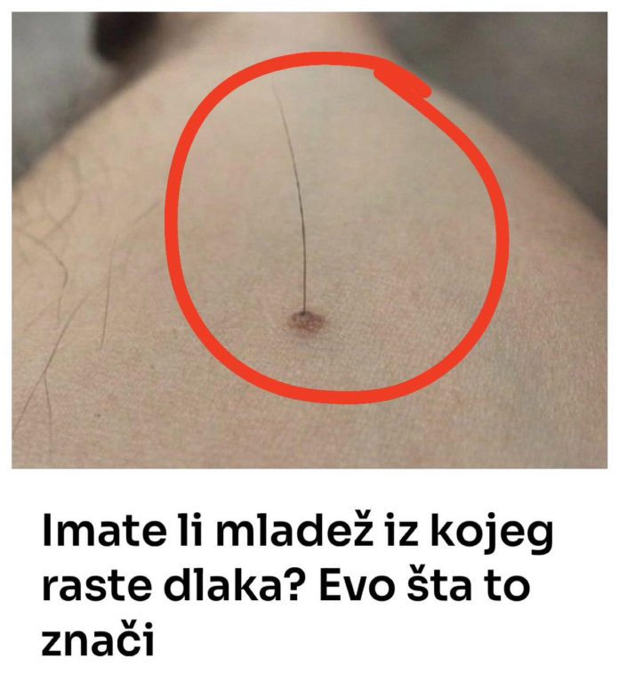 Evo šta tačno znači kada vam iz mladeža raste dlaka: Da li je to opasno, iznenadit ćete se - featured image Evo šta tačno znači kada vam iz mladeža raste dlaka: Da li je to opasno, iznenadit ćete se - featured image
