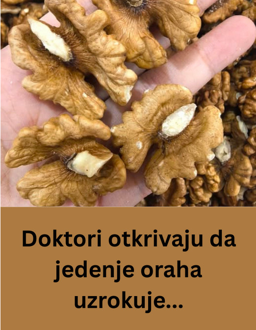 Doktori otkrivaju da jedenje oraha uzrokuje… - featured image Doktori otkrivaju da jedenje oraha uzrokuje… - featured image
